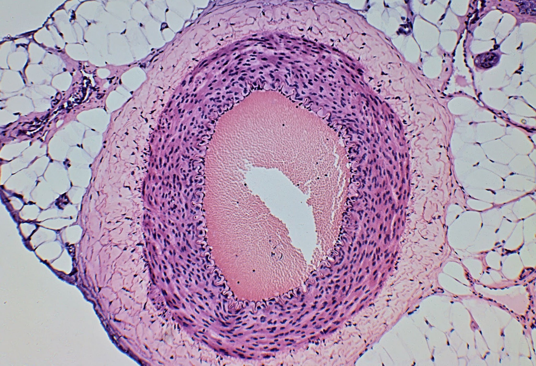 Artery c.s. | Motic BA310E Epi-LED FL Planfluar 10X | Moticam 10+