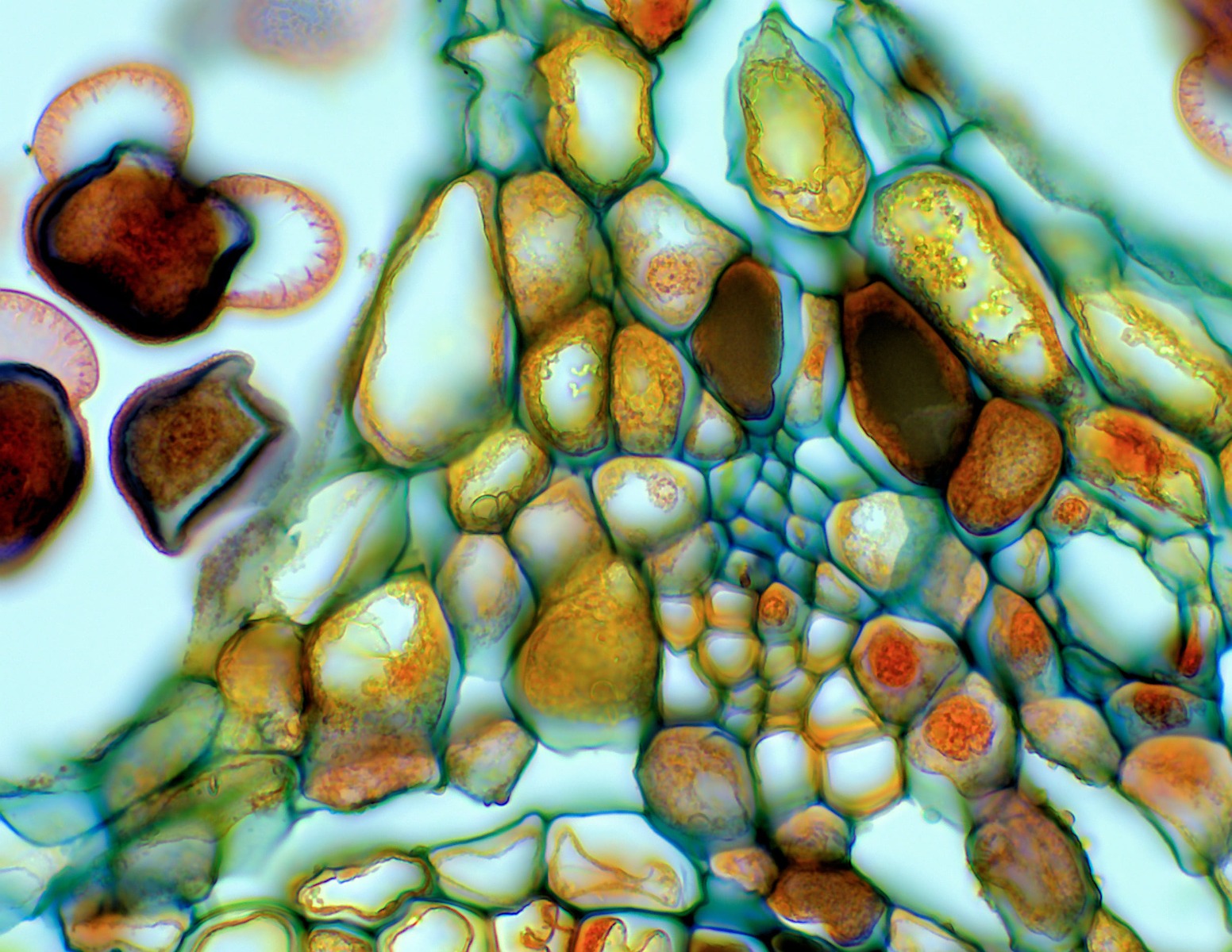 Male pine cone seen under the Motic Panthera C microscope