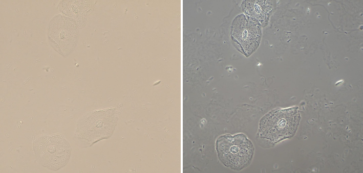 Squamoous epithelia cells - Comparison between Brightfield and Phase Contrast