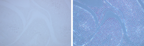                                  Section of rabbit testicles - Comparison between Brightfield and Phase Contrast